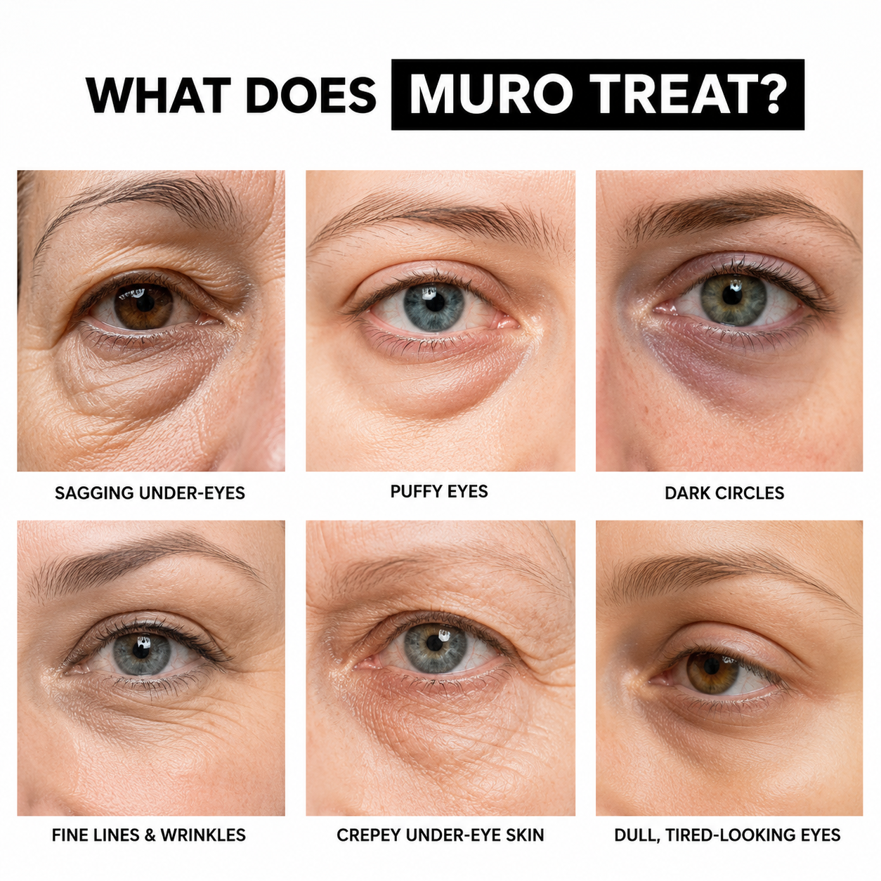 Muro™ Banana Eye Serum