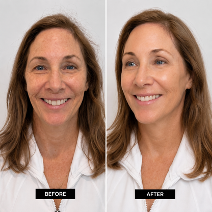 Muro™ Anti-Aging Cream